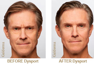 Before and After Picture - Male Aesthetics