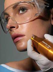 PPhotoFacial ILPS